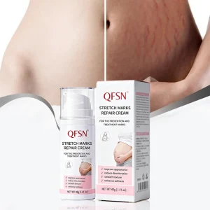 100% Natural Vegan Anti Postpartum Acne Scar Maternity Skin Care Removal Stretch Mark Cream for Tummy Boobs Hips and Thighs