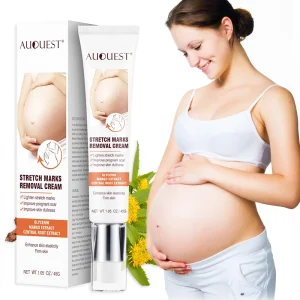 100% Natural Vegan Anti Postpartum Deep Acne Scar Removal Cream Stretch Marks Removal Cream