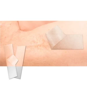 5*30cm High Quality Silicone Scar Sheets Gel Patch Reusable Silicone Scar Strips Fade Skin Scars Invisible