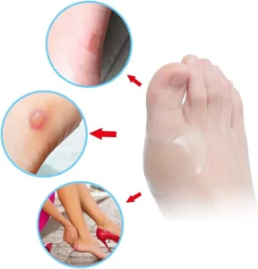 Adhesive Hydrocolloidal Heel Protectors Gel Blister Heel Anti-wear Adhesive Pedicure Patch Foot Care Tool