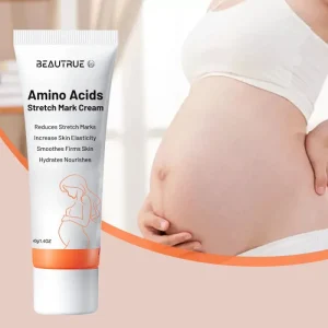 Amino Acids Stretch Mark Cream Repair Moisturizing Body Lotion Skin Firming Scar Fading Pregnancy Care Nourishing Treatment