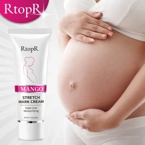 Anti Stretch Mark Cream Buttock Abdominal Pregnancy Stretch Mark Removal Cream for Legs and Thighs