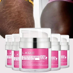 Black Skin Stretch Marks Reducer Skincare Cream Collagen Stretch Marks Remover Body Lotion