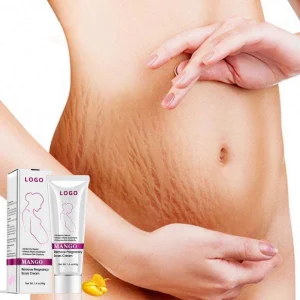 Body Care Skin Repair Remove Clear Pregnancy Scar Removal Stretch Mark Cream