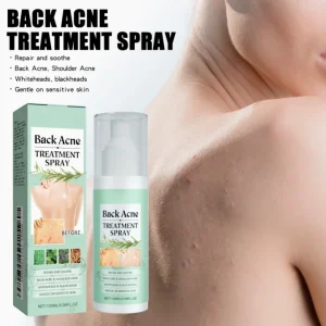 Body Care Spray Acne Removing Spray Gentle Moisturizing Hydrating and Nourishing the Skin on the Back Smoothing the Skin