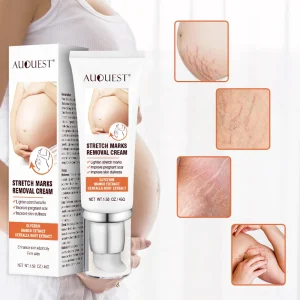 Body Cream Reducing Stretch Mark and Scar Tummy Butter Balm for Stretch Marks & Pregnancy Skin Care