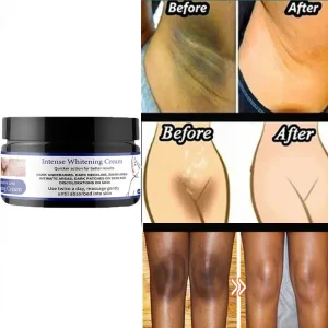Body Intimate Whitening Cream Natural Skin Care Inner Thigh Lightening Brightening Moisturizing Bikini Whitening Cream