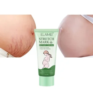 Body Skin Repair Faded Pregnancy Scars Reducing Pregnancy Scar Removal Cream Stretch Mark Cream