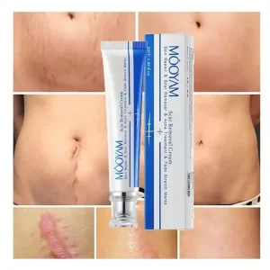 Chinese Herbal Effective Skin Repairing Gel Natural Acne Pimple Mark & Stretch Marks Scar Removing Cream
