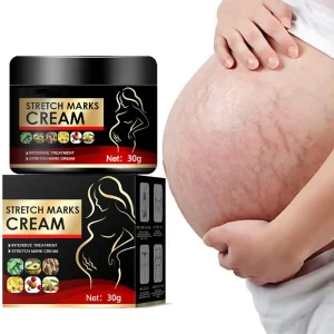 Chinese Herbal Skin Repair Anti Vergeture for Pregnancy Repair Scar Mark Stretch Mark Remover Cream
