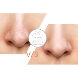 Collagen Hydrocolloid Pore Cleansing Blackhead Remover Nose Strips Pore Cleaner for Home Use