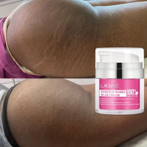 Cosmetic Organic Pregnancy Beauty Care Effective Oil Fast Anti Aging Stretch Mark Cream for Black Skin