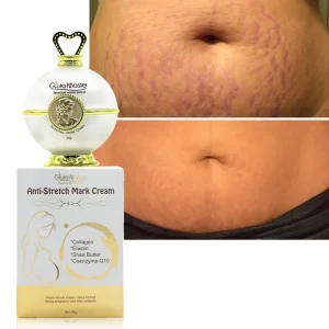 Custom Logo Natural Stretch Marks Removal Cream Skin Repair Texture Removal Nourishes Deeply Tummy Tuck Stretch Mark Cream
