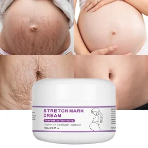 Custom Stickers Stretch Mark Cream Pregnancy Care Pregnant Woman Products Health Care Products