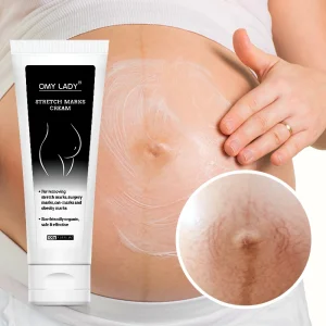 Custom logo 100% Safe Omy Lady Effective High Quality Damaged Skin Repair Stretch Marks Removal Cream