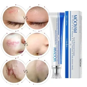 Custom logo Herbal Skin Repairing EffectivecGel Natural Acne Pimple Mark Stretch Marks Cream Scar Removing Cream