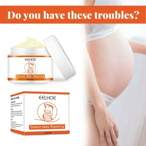 Customized Gentle Formula Moisturizing and Soothing EELHOE Stretch Mark Repair Cream