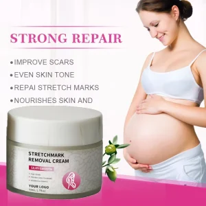 Customized Logo Stretch Marks Removal Cream 100% Natural Anti Postpartum Deep Acne Scar Stretch Mark Removal Cream