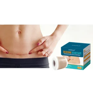Customized Patches Scar Atrophic Patch for Scars Silicone Scar Gel Patch