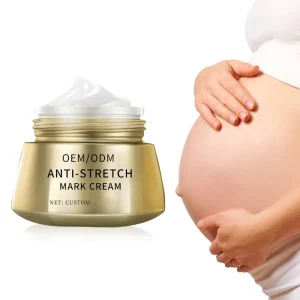 Direct Factory Sale Organic Ingredients Body Lotion Lightening Moisturizing Anti Stretch Mark Removal Cream