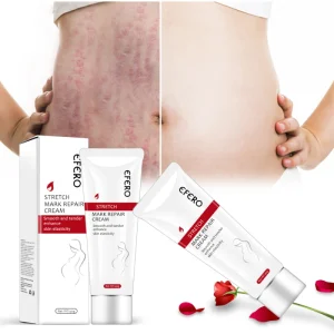 EFERO Stretch Mark Cream OEM ODM Private Label 100% Natural Vegan Anti Postpartum Acne Scar Removal Stretch Mark Cream