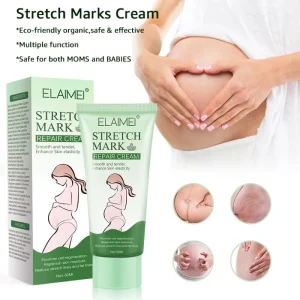 ELAIMEI Cross Border Postpartum Stretch Mark Repair Cream Eco Friendly for Body Reduces Pregnancy related Melanin Lines Enhances