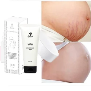 Effect Anti Stretch Mark Cream for Pregnant Women
