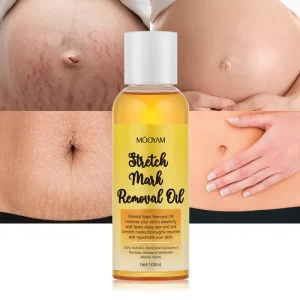Effective Fastest Scar Removal Oil Moisturizing Smoothing Body Skin Care Product 100ml Stretch Mark Remove Oil