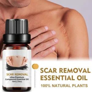 Effective Fastest Scar Removal Oil Moisturizing Smoothing Body Skin Care Product Stretch Mark Remove Oil