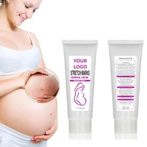 Effective Stretch Mark Removal Cream Pregnancy Repair Gel for Women Smooth Skin