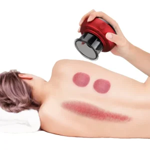 Electric Smart Cupping Therapy Massager for Sale Cupping Therapy Massager