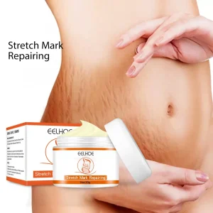 Enhance Skin Elasticity Repair Scar Removal Stretch Marks Cream