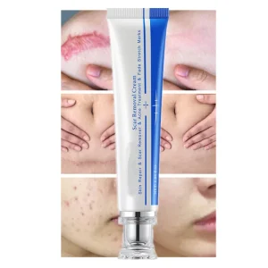 Face Body Skin Care Strong Effective Fastest Acne Scar Gel Bruises Repair Tummy Tuck Tightening Stretch Mark Scar Removal Cream