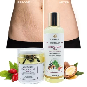 Factory Body Care Vitamin E Collagen Repair Cream for Damaged Skin and Stretch Marks Oil