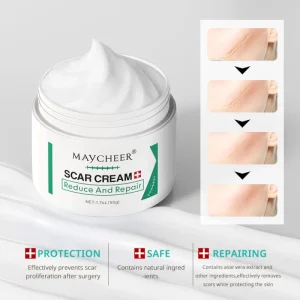 Factory Price Body Scar Repair Body Scar Cream 50g Natural Reduce and Repair Scar Removal Cream