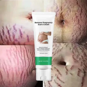 Factory Price Skin Repair Cream for Stretch Mark and Acne Scar Removal for Body