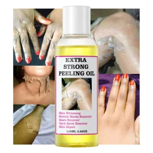 Factory Pure Essential Oil Body Care Dark Knuckle Scars Extra Strong Brightening Peeling Oil Dark Spots Remover