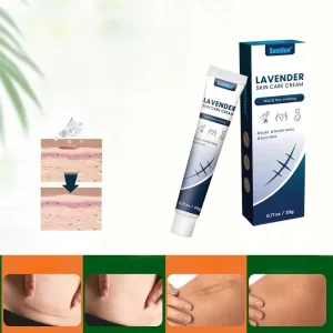 Fastest Acne Scar Removal Cream Face Care Scar Gel Bruise Repair Cream Tummy Tuck Tightening Stretch Mark Scar Removal Cream