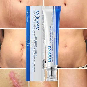 Fastest Scar Removal Cream Bruises Repair Scar Gel Tummy Tuck Tightening Cream Scar Stretch Mark Remove Cream