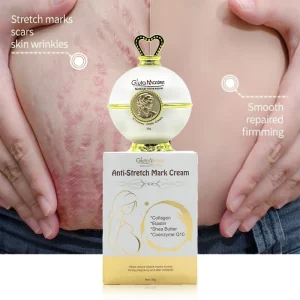 Fat Stretch Mark Cream Women Repair Removal Firming Nourishing Pregnancy Mark Tummy Tuck Stretch Marks Cream