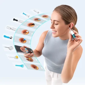 For Earsight Ultra Visual Earwax Pick Cleaner ENT Ear Health Care Set Smart Ear Spoon 5G Image Transmission IP67 Waterproof
