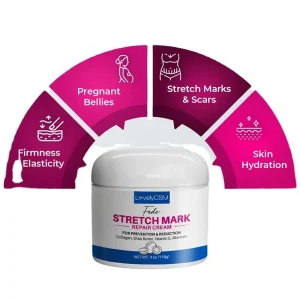 Glycerin Based Facial Cream for Stretch Mark Scar Fat Line Removal on Legs Old Scars Repair Cream