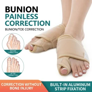 Hallux Valgus Corrector Big Toe Bunion Splint with Adjustable Strap All Day Orthopedic Toe Separator for Pain Relief Alignment
