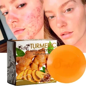 Handmade Solid Rose Bar Soap Skin Scrub for Face & Body Whitening Blemish Removing All Skin Types Low Price