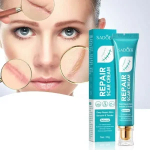 Herbal Body Care Repair Burns Rejuvenate Skin Reduce Stretch Marks Scar Repair Cream