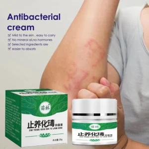 Herbal Itch Relief & Detox Natural Plant Soothing Cream Relieve Skin Discomfort Daily External Care Cream