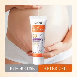 High Quality Powerful Stretch Marks Remover Skin Repair Cream Treatment Scar Removal Pregnancy Cream Body Adults GMP Moisturizer
