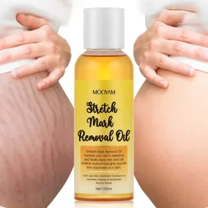 High Quality Vitamin E Stretch Marks Cream Natural Ingredients Skin Care Stretch Mark Removal Oil