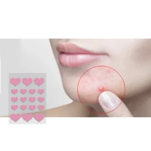 Hydrocolloid Absorbing Acne Pimple Patch 3 Size Patches for Blemishes and Zits Cover Spot Stickers for Face and Body