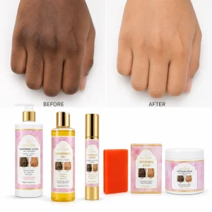 LAMARINE Dark Skin Whitening Kit for Body Knuckles Elbows Knees Arbutin Vitamin C Collagen Custom Packaging